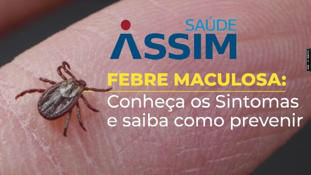 Febre Maculosa - Conheça os Sintomas e saiba como prevenir