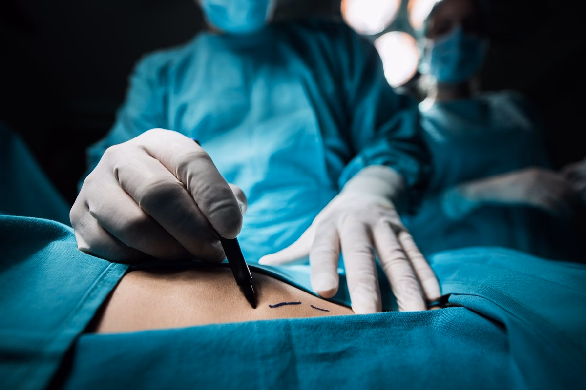 Descubra Quais Planos de Saúde Cobrem Cirurgias no Rio de Janeiro em 2025