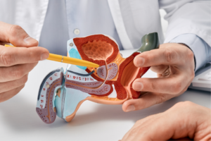 Câncer de Próstata: Entenda os Exames Essenciais e as Melhores Estratégias de Prevenção