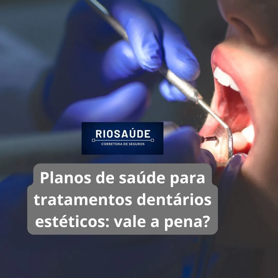 Planos de saúde para tratamentos dentários estéticos vale a pena