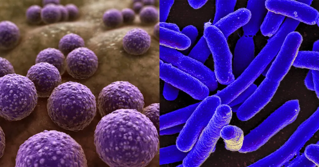Diferença entre vírus e bactérias: Um guia completo para entender as particularidades Diferença entre vírus e bactérias: Um guia completo para entender as particularidades