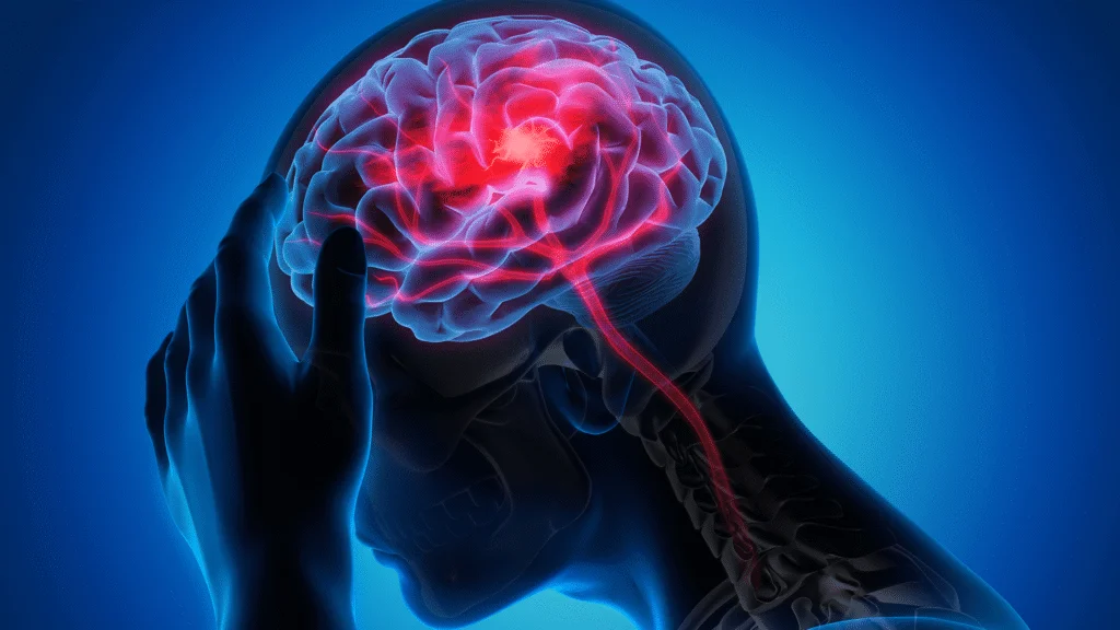 AVC: Identifique os Sinais de Alerta e Saiba Exatamente o Que Fazer Imediatamente AVC: Identifique os Sinais de Alerta e Saiba Exatamente o Que Fazer Imediatamente